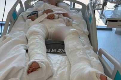 Otomobilin çarptıktan sonra üzerinden geçtiği genç kız ağır yaralandı
