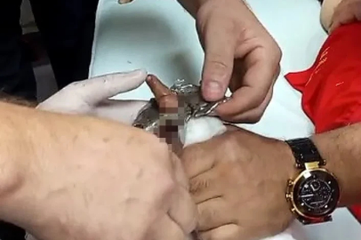 Bitlis’te parmağı çelik halkaya sıkışan çocuk itfaiye ekiplerince kurtarıldı
