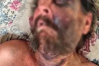 "Abimin cenazesine neden gelmedin" diyerek dövüp ölüme terk etmişler
