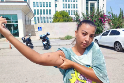 Cankurtaran kadın, öğretmen amcası tarafından darp edildi
