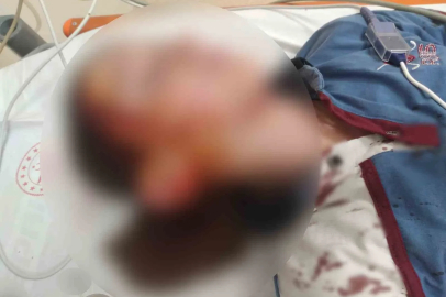 Köpek saldırısında yaralanan çocuk için 1 milyon 200 bin tazminat
